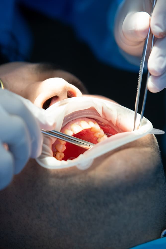 Meilleur dentiste près de chez vous à Marrakech – Votre guide pour des soins dentaires de qualité